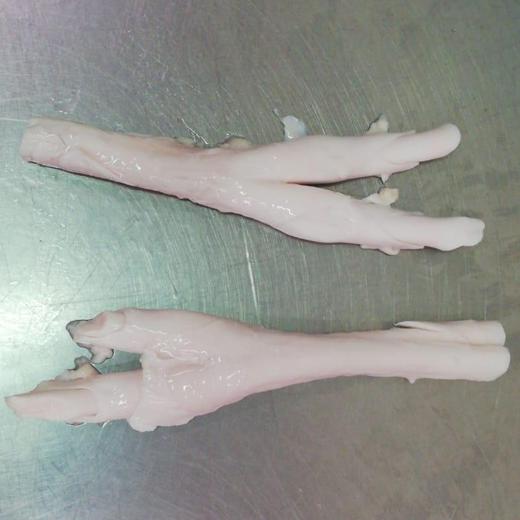 tendon