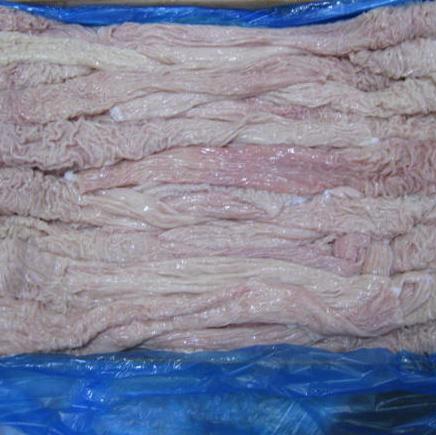 Rectum img1